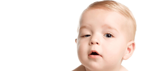 cirugía de ptosis congénita en Rosario